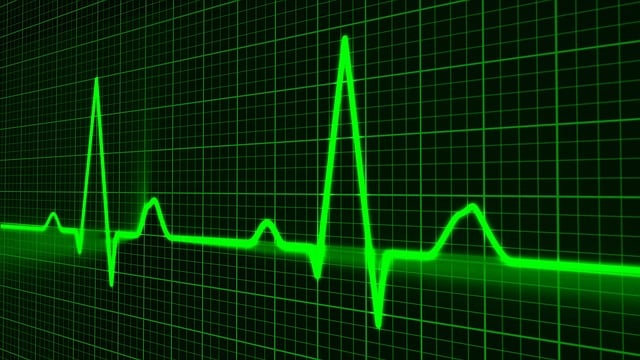 Kompiuterių ir kavos aparatų remonto įmonė „Techremontas“ investuoja į širdies medicinos įrangą
